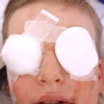 Found a firecracker recipe on TikTok: 9-year-old boy in Chernivtsi received severe eye burns